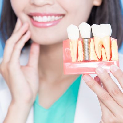 Dental implants in Brampton