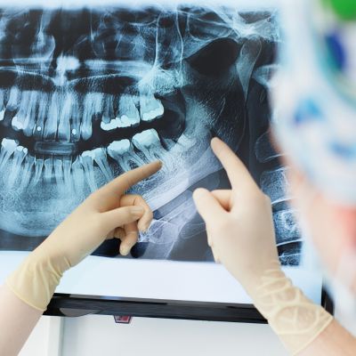 Digital X-rays in Brampton