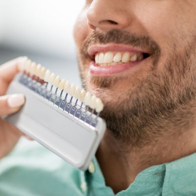 Dental Veneers in Brampton